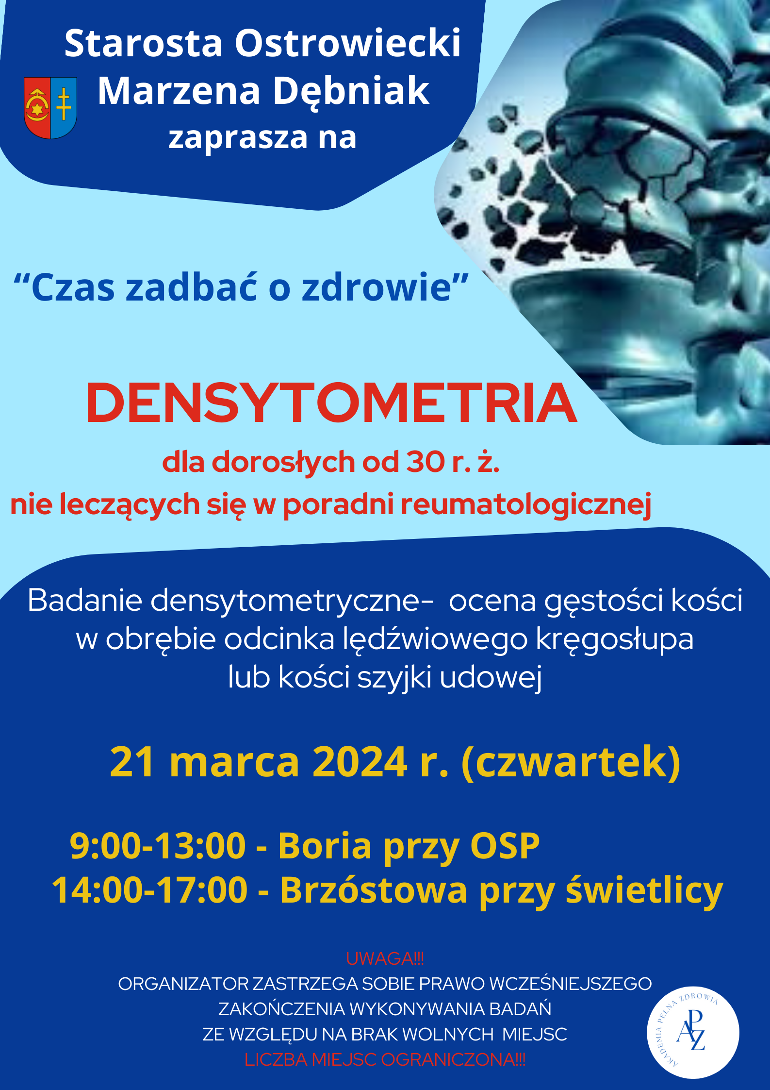 Zapraszamy na badania densytometryczne