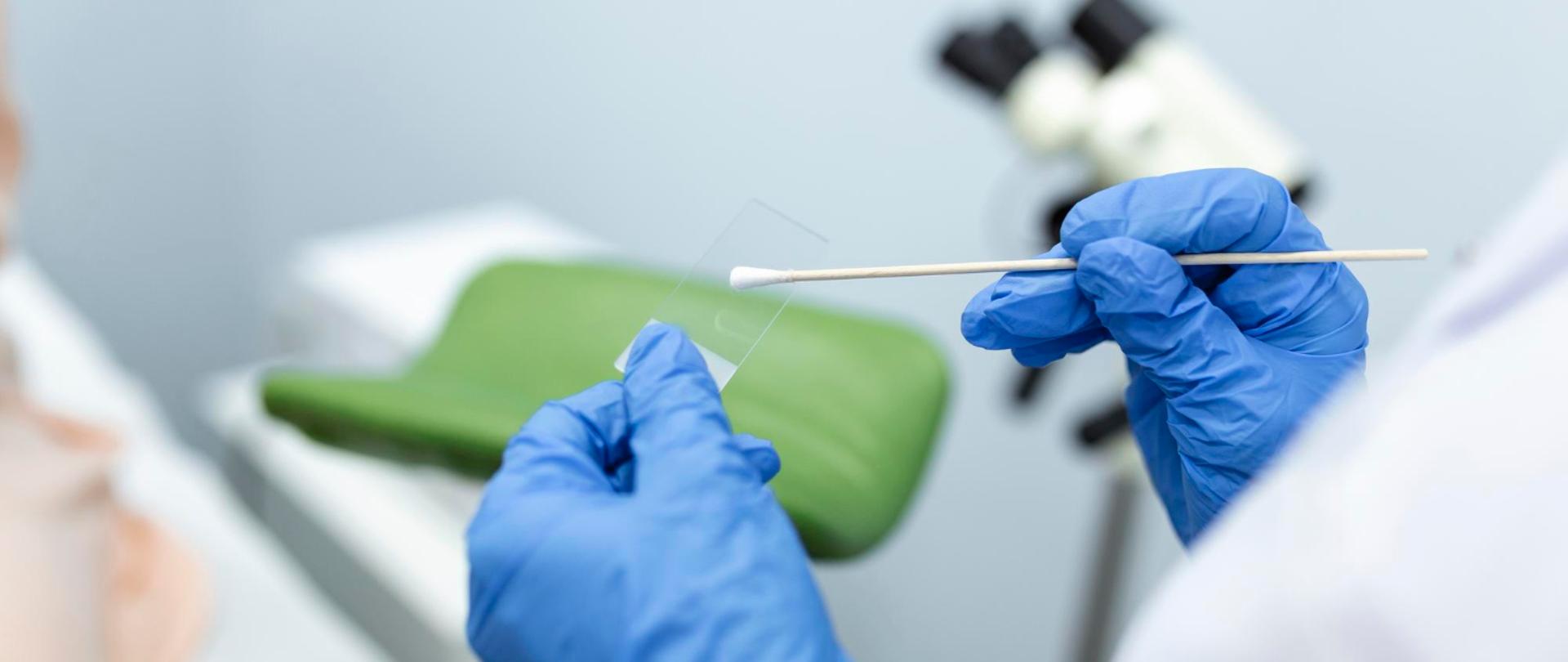 Zbliżenie na dłonie osoby w jednorazowych, niebieskich rękawiczkach medycznych, trzymającej patyczek do pobierania wymazu oraz szkiełko mikroskopowe. W tle widoczny jest fotel lekarski i mikroskop w gabinecie medycznym.